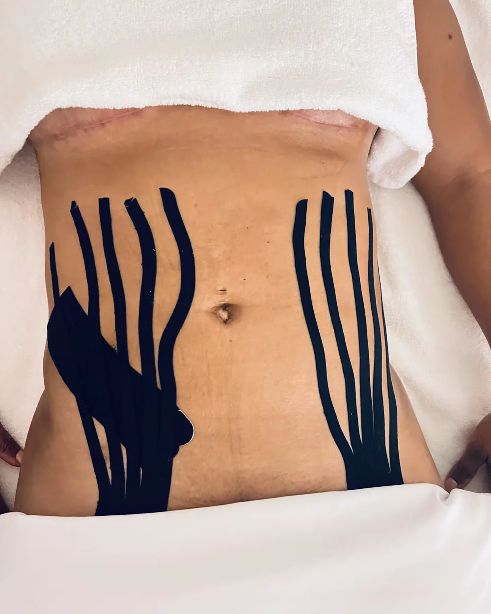 Real post-operative taping care at Reviv Spa in Fort Lauderdale